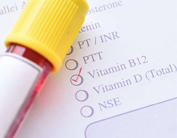 Vitamin-B12-Mangel? Säureblocker als mögliche Ursache - Der niedergelassene  Arzt