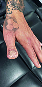 Fingernageltattoo auf einem Daumenstumpf nach distaler Amputationsverletzung. Foto: Lexi Hanna http://www.honorboundtattoos.com